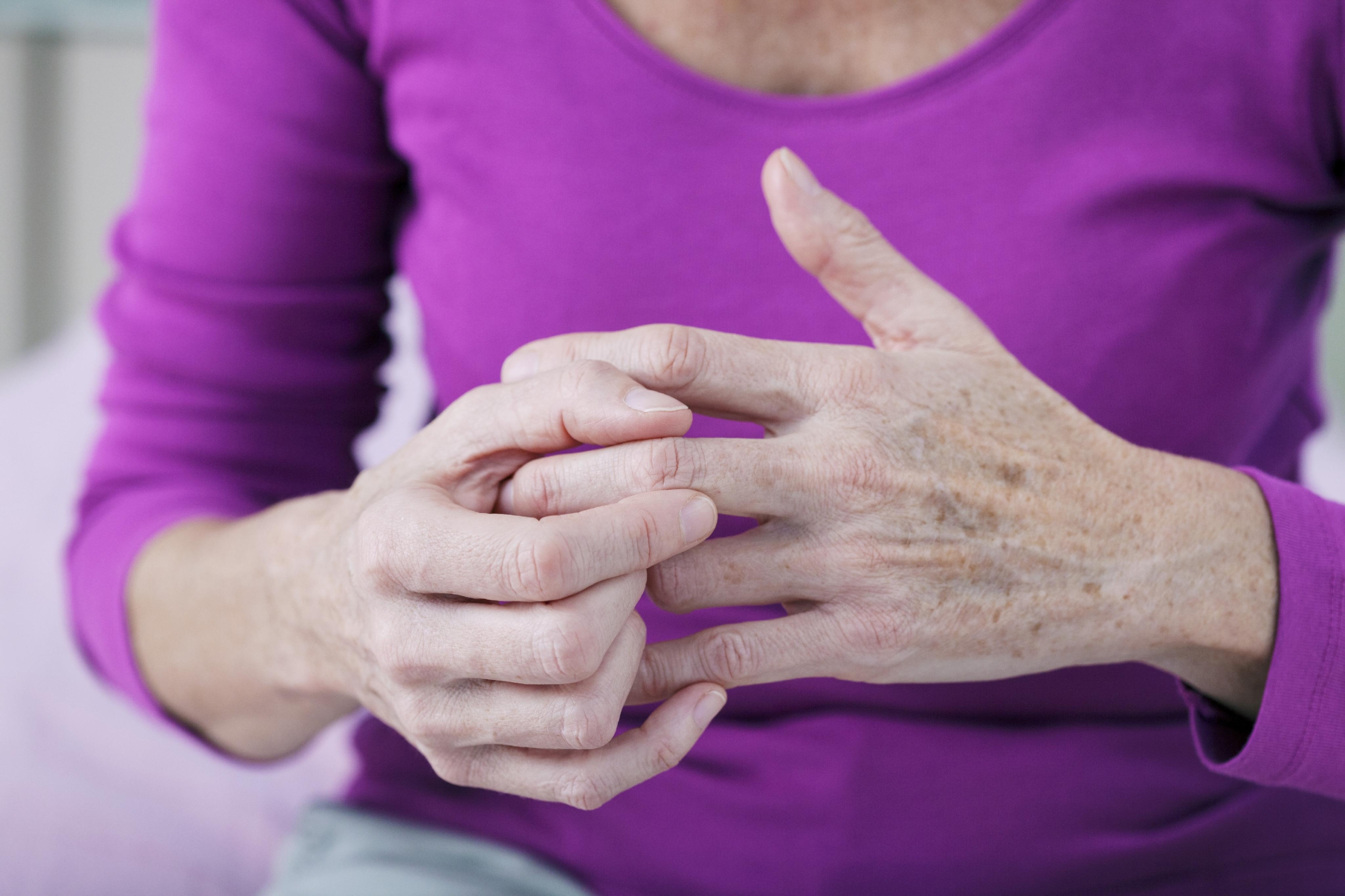 May Is Arthritis Awareness Month